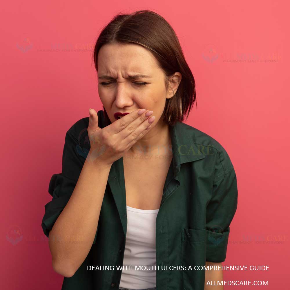 Effectively Dealing with Mouth Ulcers- Total Proven Guide!